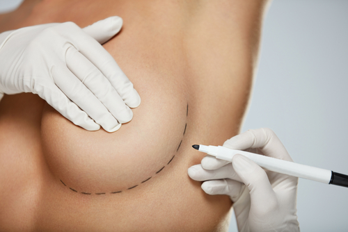 Breast Reconstruction Options