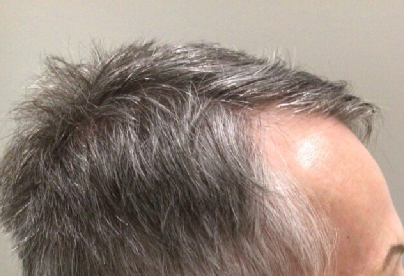 Before