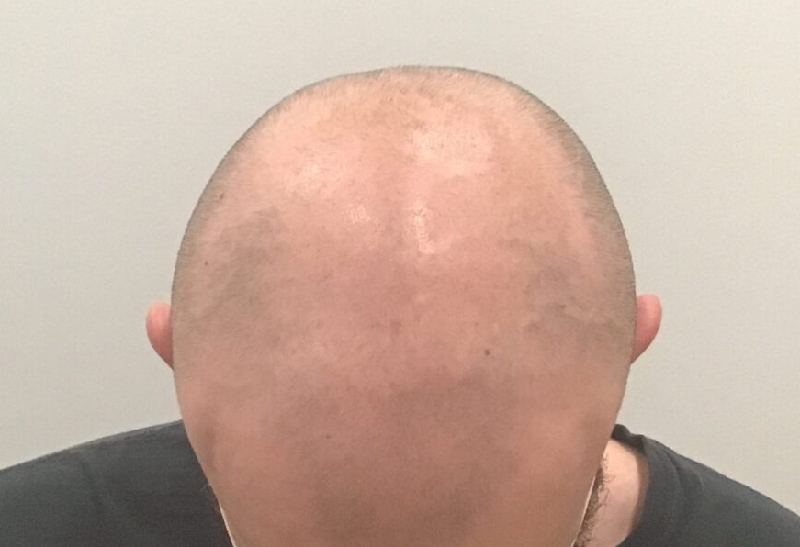 Before