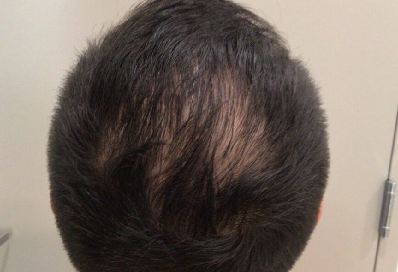 Before